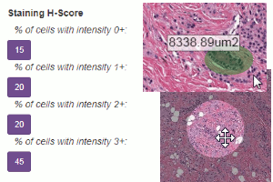 Made for pathologists - H-Score, measurements, eyepiece