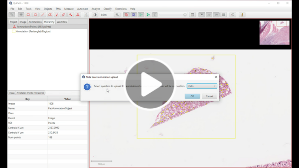 Youtube: QuPath analyzing slides stored in Slide Score