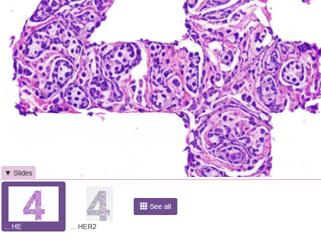 replacing case names - slide drawer