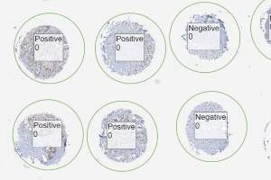 Review TMA cores' scores