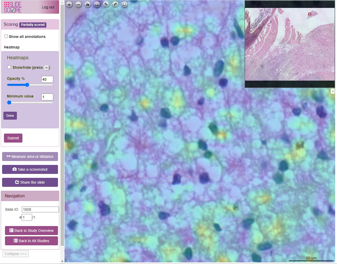 Pathology slide viewer Slide Score