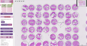 Support for scoring tissue microarray whole slide images