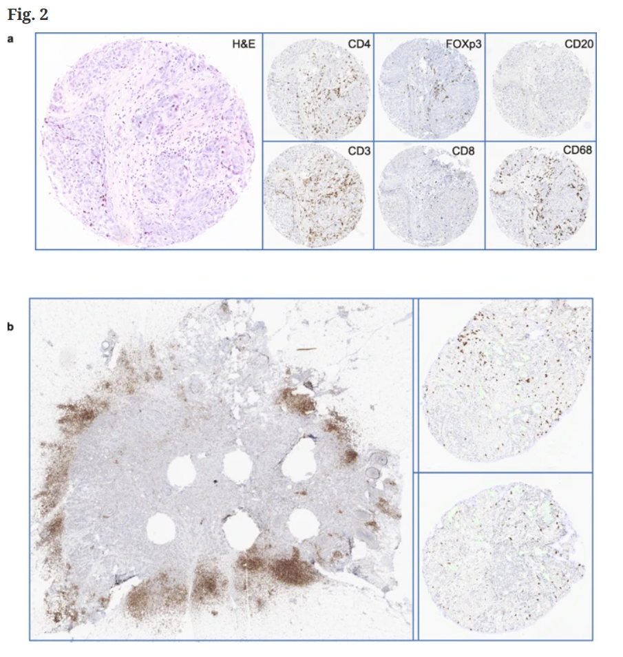 Another paper using Slide Score published