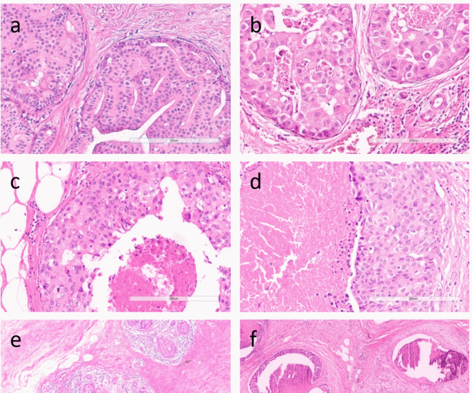 DCIS Features