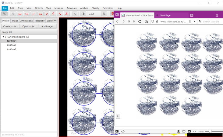 QuPath and Slide Score